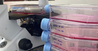 Pesquisa do Inpa transforma compostos da Amazônia em arma promissora contra o vírus da Zika Pesquisa do Inpa transforma compostos da Amazônia em arma promissora contra o vírus da Zika