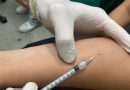 Manaus amplia teste que ajuda a prevenir tuberculose