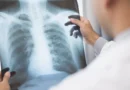 Médico analisa uma radiografia. Os sintomas do paciente, identificados na radiografia, e os resultados são relatados online por meio de videoconferência. Foto: Chanakon/AdobeStock